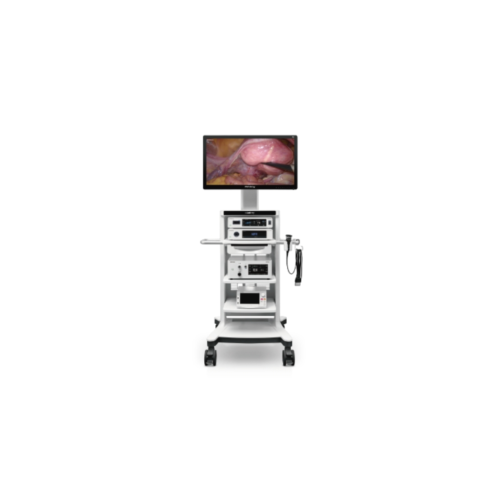 Image of HYPIXEL UX3 laparoscopic system.