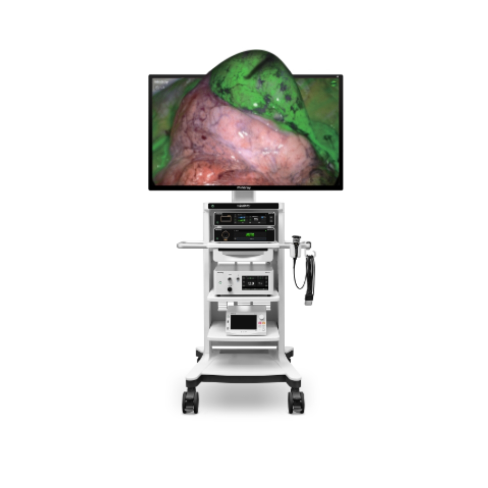 Image of HYPIXEL UX7 laparoscopic system.