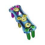 Image of MS posterior pedicle screw system.